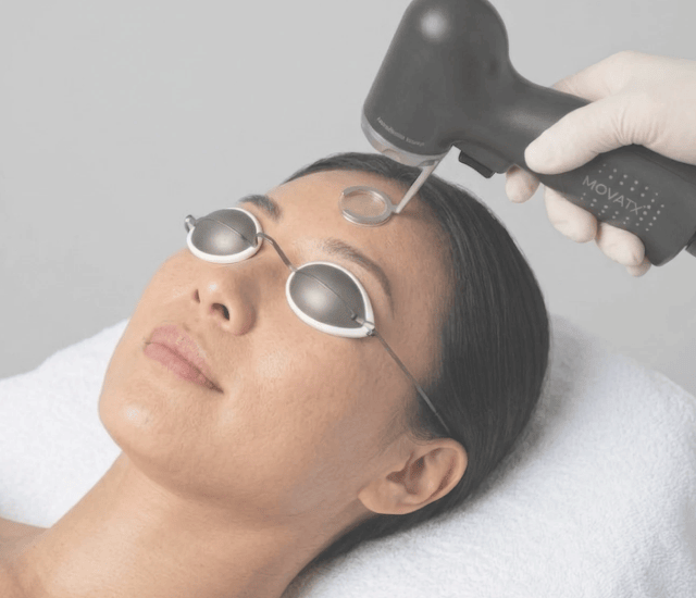 Patient in laser eye shields receiving a laser treatment for acne