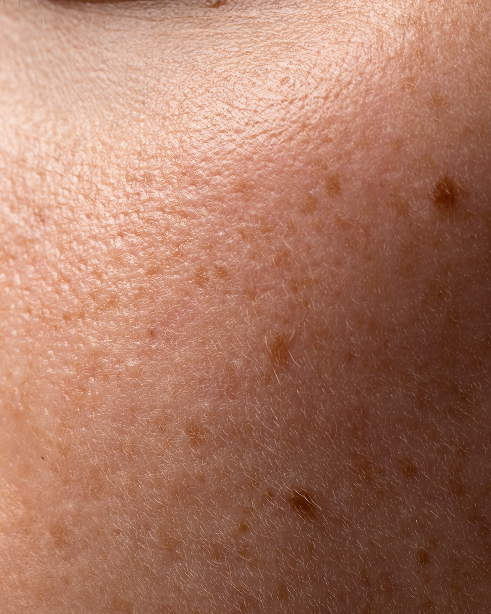 Dull Skin