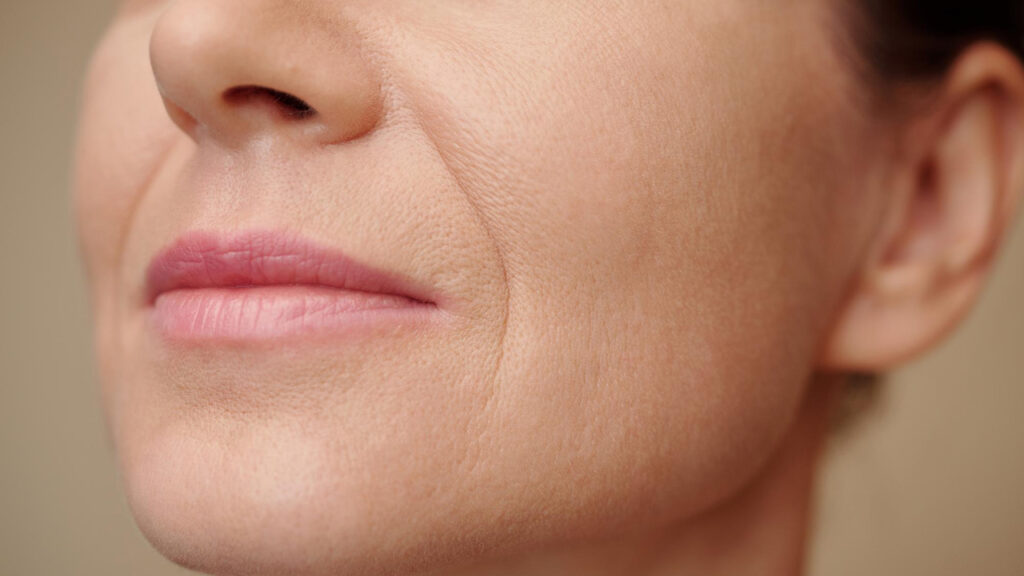 facial sagging