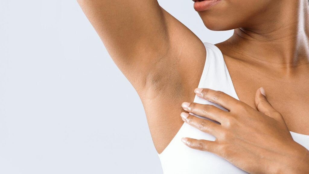 Underarm Pigmentation