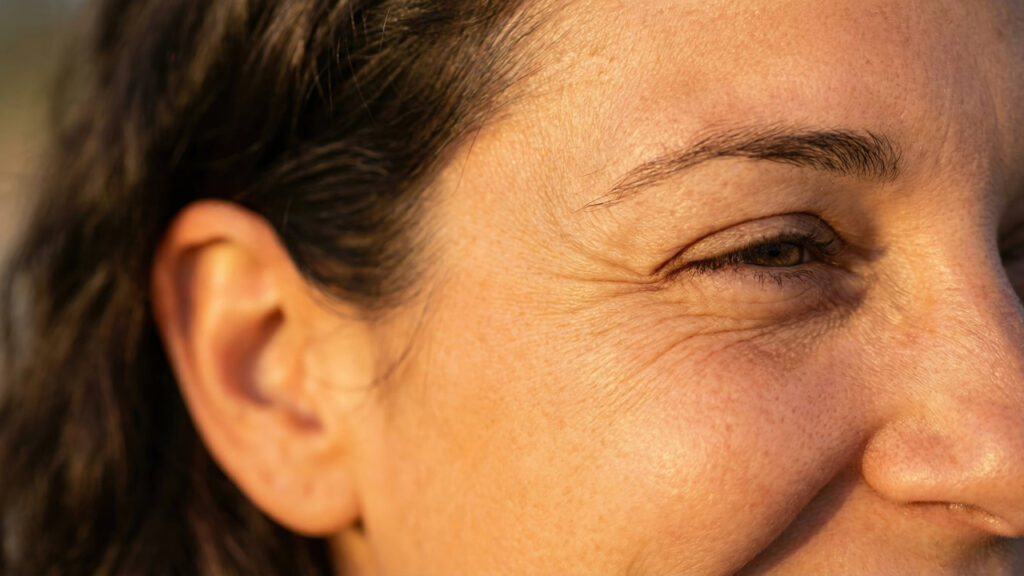 Wrinkles